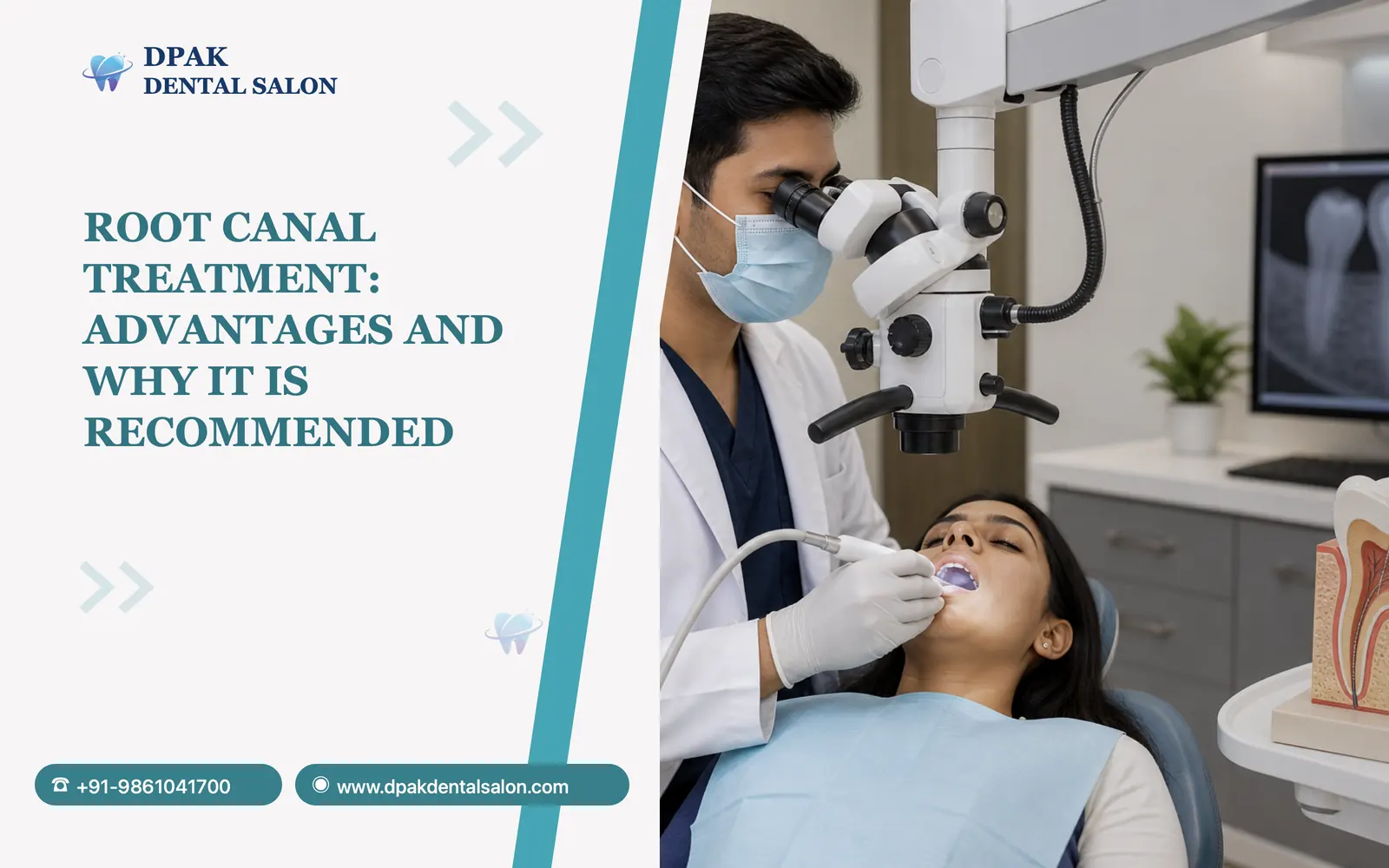 Root Canal Treatment: Advantages and Why It Is Recommended